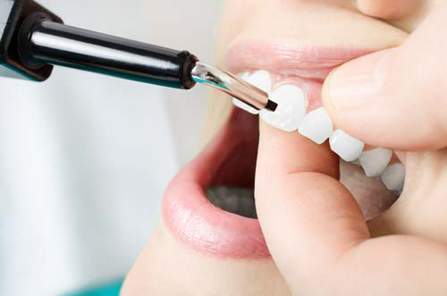 dentista-foligno-spello-parodontologia-01
